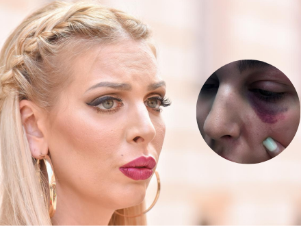 Ava Karabatić oprostila nasilje bivšem zaručniku: On je ljubav mog života