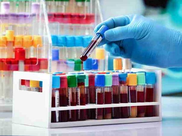 Britanski naučnici razvili test krvi koji otkriva bolesti deset godina prije simptoma