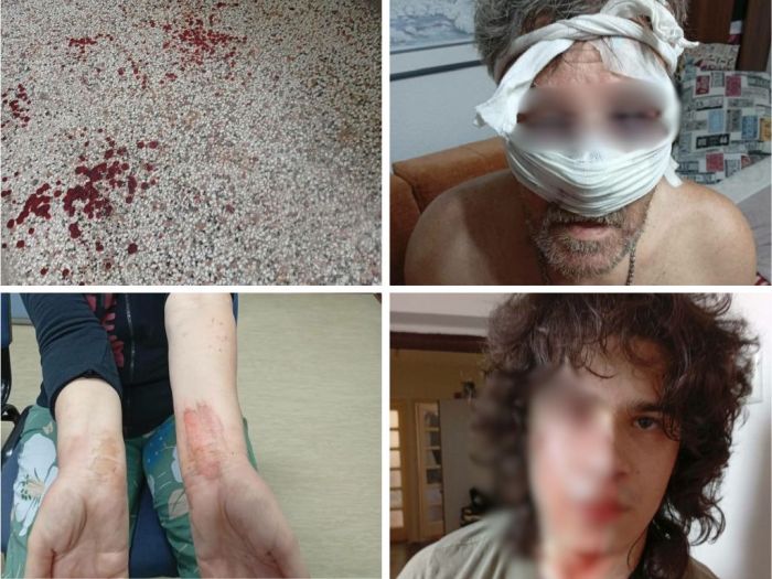 Brutalno pretučena porodica u Tuzli: Jedna osoba uhapšena