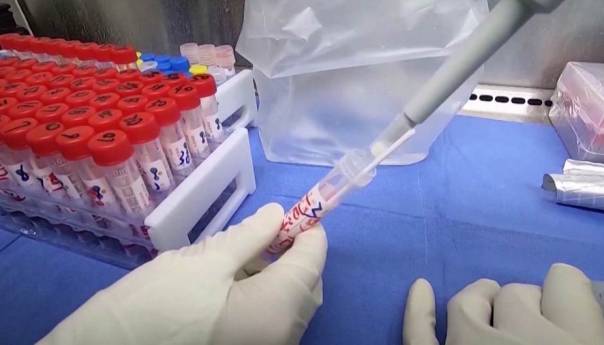 Crna Gora: Preminula dva pacijenta, 30 novozaraženih