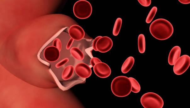 Danas se obilježava Svjetski dan hemofilije