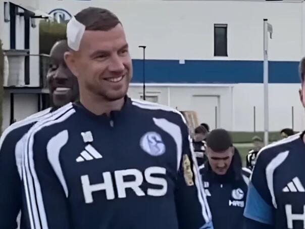 Džeko se pojavio na treningu s flasterom na glavi, Muslić ima dobre i loše vijesti