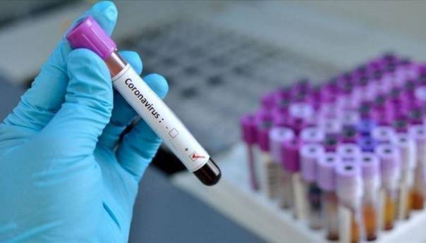 Hrvatska: 430 novozaraženih koronavirusom, umrlo osam osoba