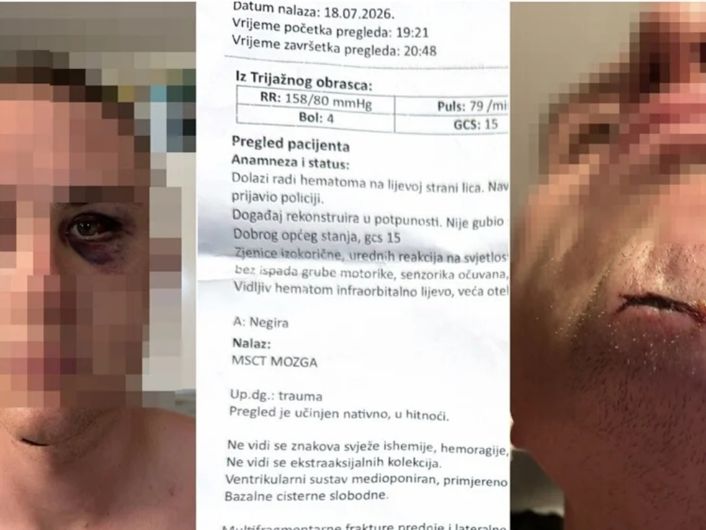Iz čista mira: U Hrvatskoj brutalno pretučeni Slovenci