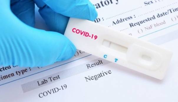 KCUS: U Sarajevu još 31 osoba pozitivna na koronavirus
