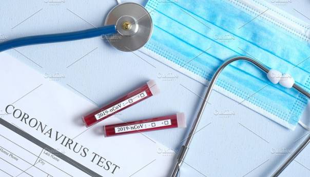 Koronavirus: U Sloveniji do sada 97 testova, svi negativni
