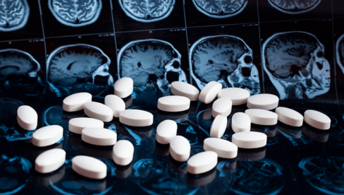Krajem godine i u Evropi prvi lijek protiv Alzheimera