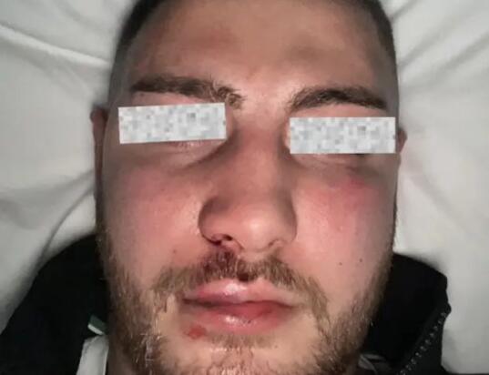 Mladić i djevojka iz Zagreba brutalno pretučeni u Beogradu