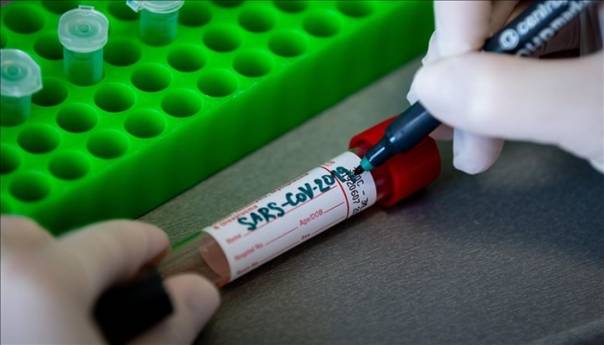 Najnoviji statistički podaci MCP-a o koronavirusu u BiH