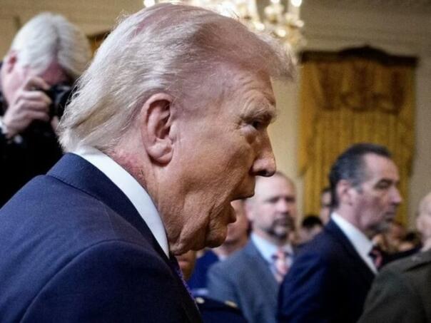 Objavljena fotografija crvene mrlje na Trumpovom vratu