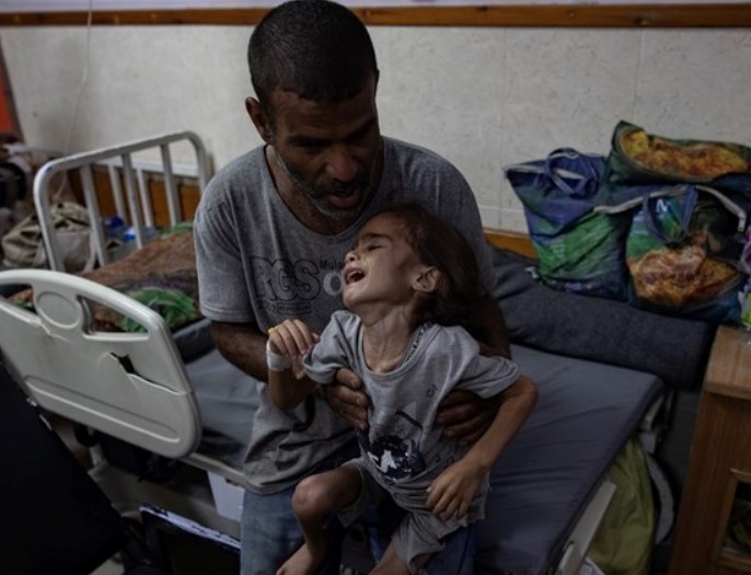 Oko desetero djece u Pojasu Gaze svakog dana ostane bez jedne ili obje noge