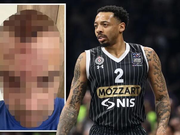 Ovako izgleda momak kojem je igrač Partizana razbio flašu o glavu