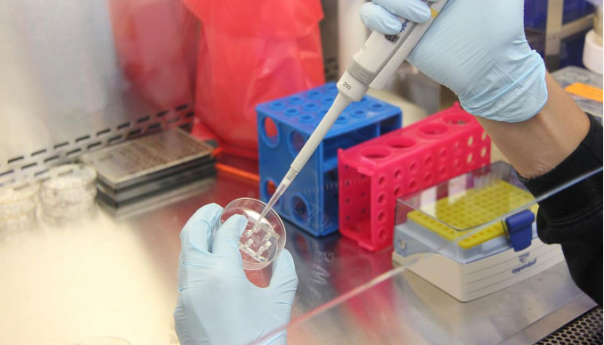 Ovo su simptomi majmunskih boginja