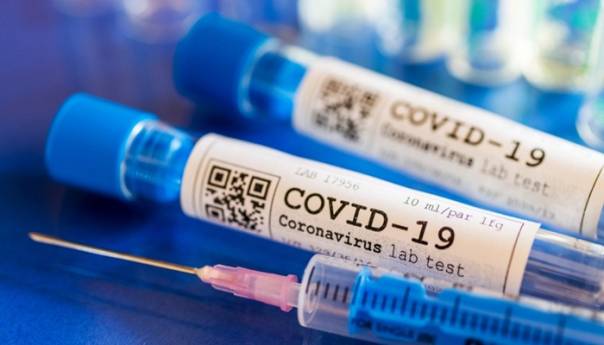 Pandemija virusa COVID-19: Devet razloga zbog kojih ne treba da paničite