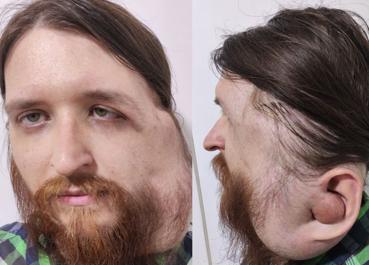 Pokrenut apel za Jasenka iz Tuzle: Jedan poziv njemu znači život