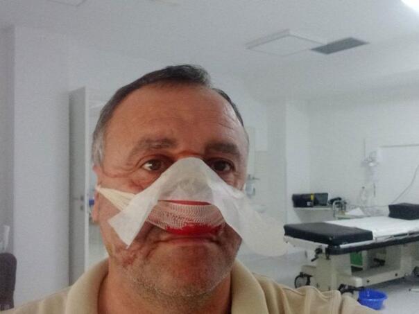 Pretučen kandidat za načelnika općine Rudo