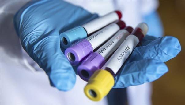 Rizik od korona virusa povećan kod onih koji imaju krvnu grupu A