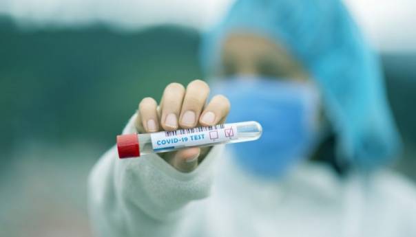 S. Makedonija: 88 novih zaraza koronavirusom, šest osoba umrlo