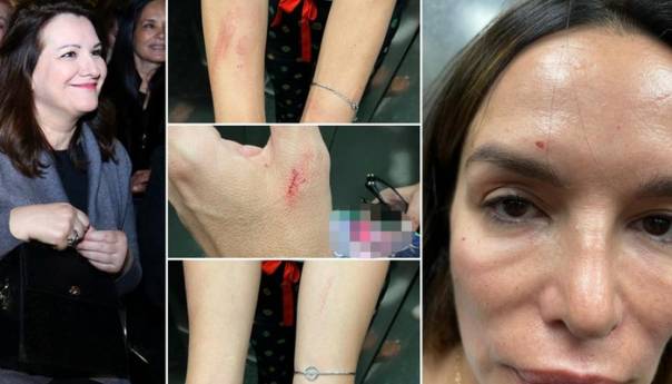 Severina uhićena na aerodromu nakon sukoba sa sestrom