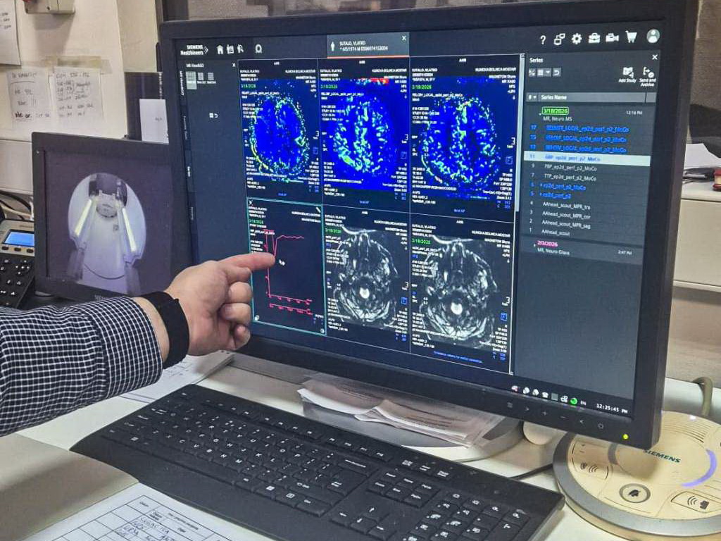 SKB Mostar uvela MR perfuziju mozga i unaprijedila radiološki sistem