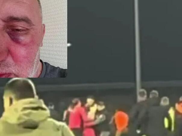 Sloga objavila video tučnjave: "Igrači Želje pretukli našeg fotografa"