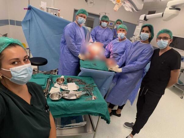 Složen zahvat u UKC RS-a: Ljekari uspješno uklonili veliki tumor