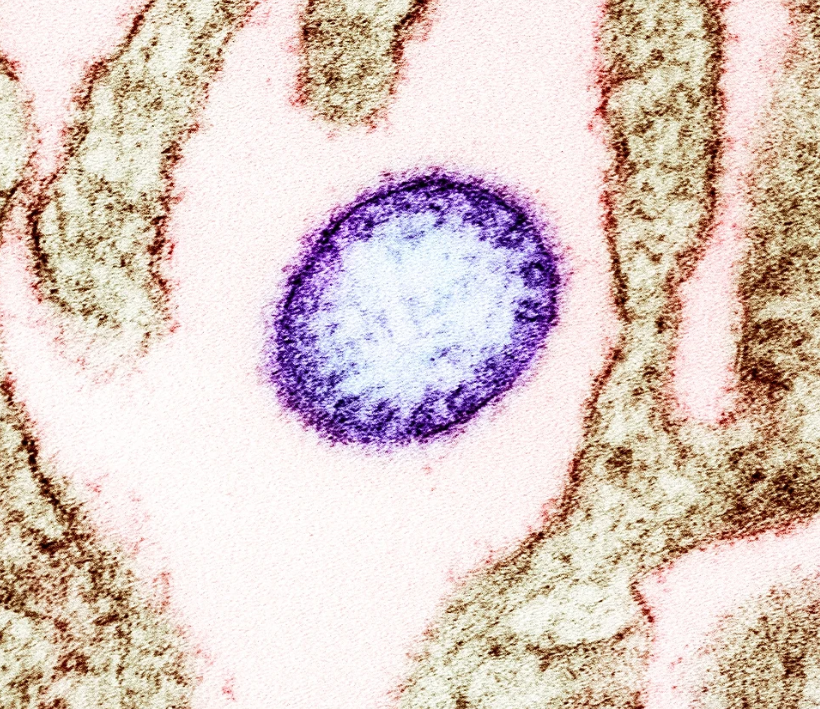 Šta je neizlječivi virus Nipah zbog kojeg je Azija na nogama?