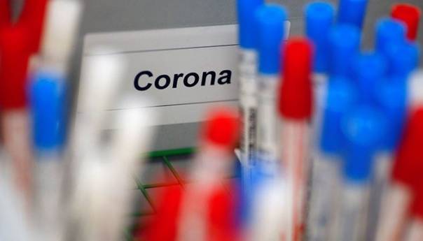 Šta nam govore rezultati seroloških ispitivanja na virus korona?