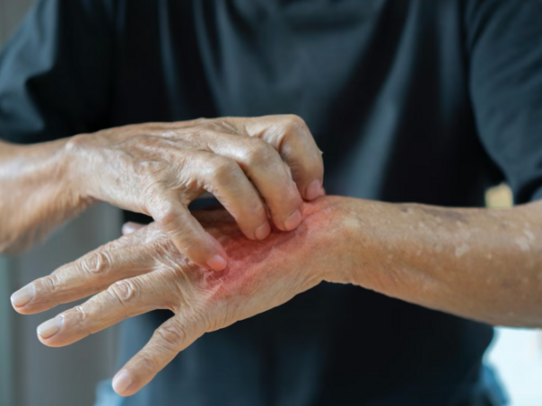 Zaraza se širi Srbijom, građani u panici: "Nisu krivi strani radnici, nego nehigijena"