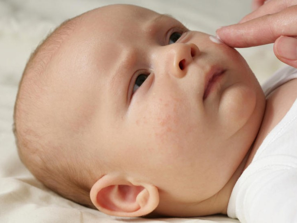 Suha i osjetljiva koža kod beba: Savjeti koji zaista pomažu