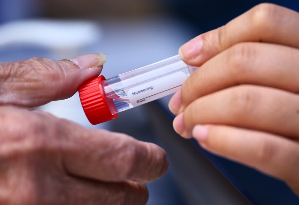 Test sline mogao bi otkriti skriveni rizik od zatajenja srca