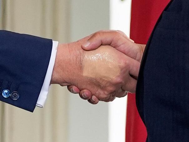 Trumpovo zdravlje ponovo u fokusu nakon najave pregleda