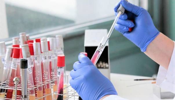 U BiH 141 novooboljeli i tri smrtna slučaja od koronavirusa