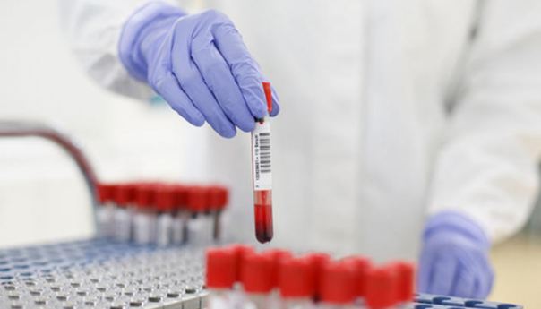 U BiH 343 novozaraženih, prijavljeno 12 smrtnih ishoda