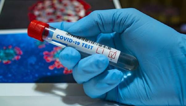U BiH 82 novozaraženih koronavirusom, preminula jedna osoba