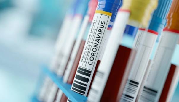 U BiH registrirano 187 novozaraženih koronavirusom