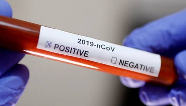 U Crnoj Gori potvrđen još jedan slučaj zaraze koronavirusom