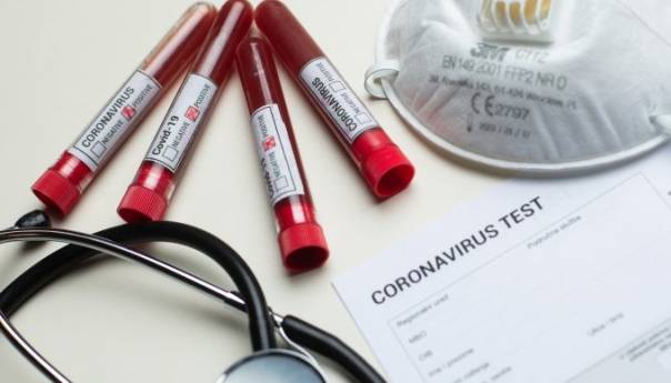 U Hrvatskoj 144 novih slučajeva koronavirusa