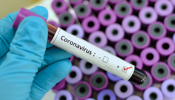 U Hrvatskoj 68 novih slučajeva koronavirusa, oporavljenih 92