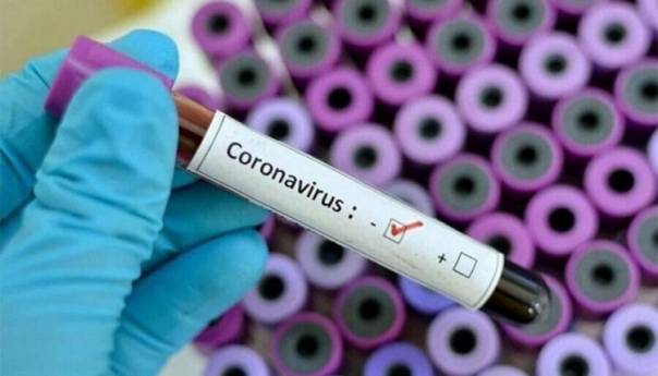 U Hrvatskoj 76 novooboljelih od koronavirusa