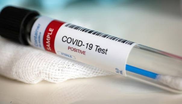 U RS jedna osoba pozitivna na koronavirus