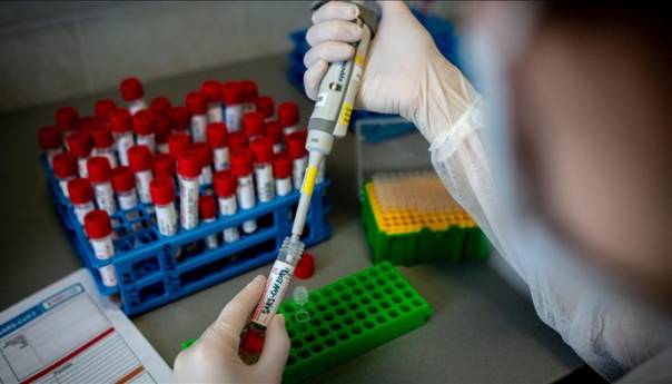 U RS još 14 zaraženih koronavirusom,  jedna žena preminula