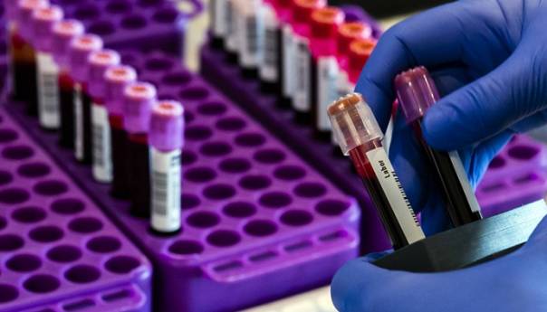 U RS još 69 novozaraženih, četiri osobe preminule