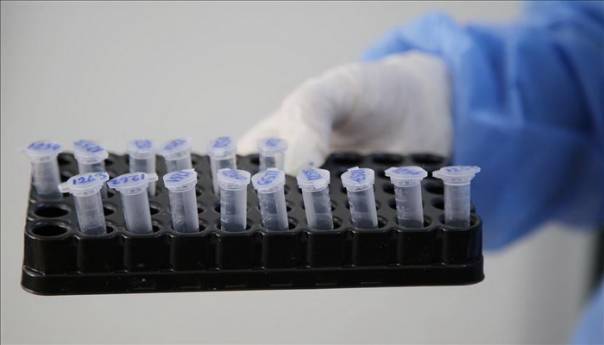 U RS još 79 zaraženih, najviše iz Bijeljine