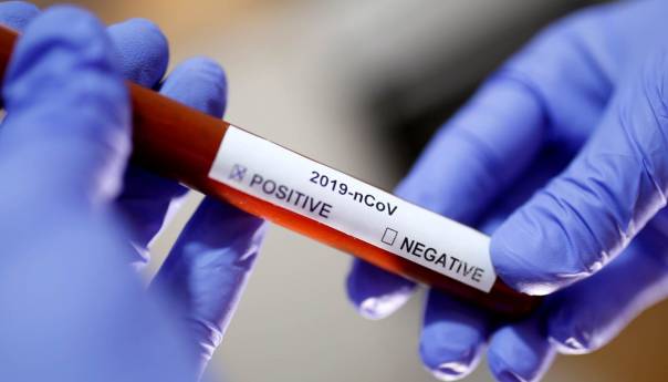 U Sloveniji 10 novih slučajeva koronavirusa