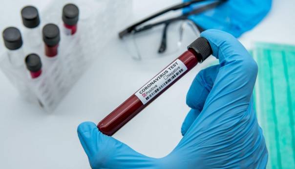 U Sloveniji 14 novih zaraza i jedan smrtni slučaj