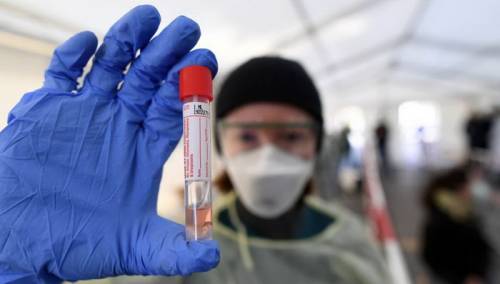 U Sloveniji 16.571 novozaraženih koronavirusom