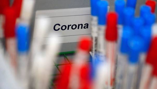 U Sloveniji 37 novih zaraza koronavirusom
