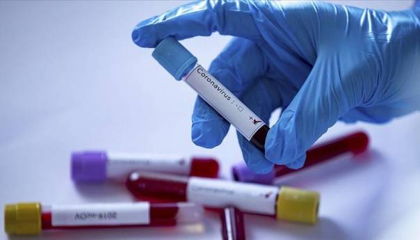 U Srbiji na koronavirus pozitivno još 339 osoba, osam preminulo