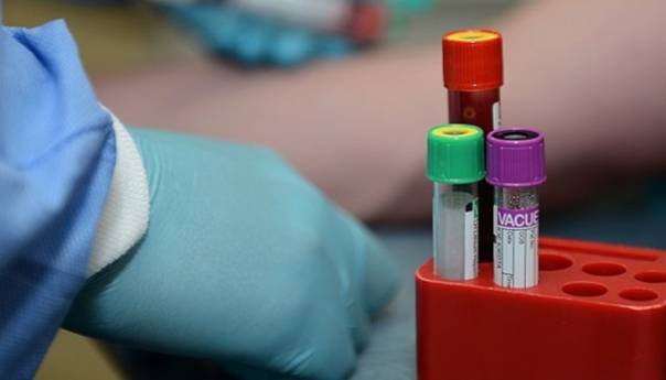 U Srbiji preminula još jedna osoba zaražena koronavirusom